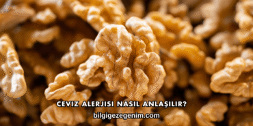 Ceviz Alerjisi Nasıl Anlaşılır?